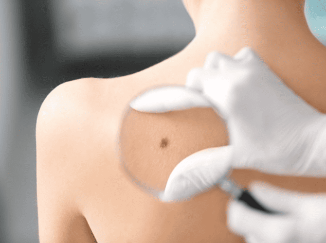Ambulatorio Dermatologia